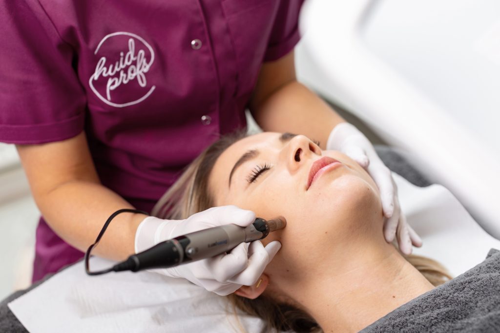 Microneedling behandeling